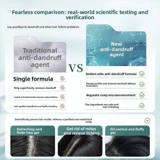 RUYI Selenium Sulfide Shampoo, Deep Anti Dandruff & Itch Relief, Long-Lasting Oil Control, Volumizing Fluffy Hair Wash