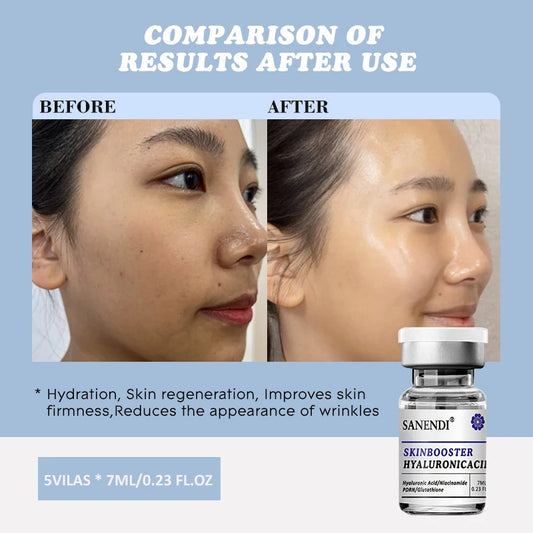 Sanendi Hyaluronic Acid PDRN GLUTATHIONE Retionl Serum for Face Dr.Pen DEEP HYDRATION Firmness Anti-aging 7ML*5Vials