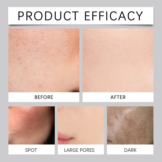 Enzyme Face Powder Wash Skin Oil Control Deep Clean Facial Pores Remove Blackheads Pimples Refreshed Enzyme Face Cleanses Flour