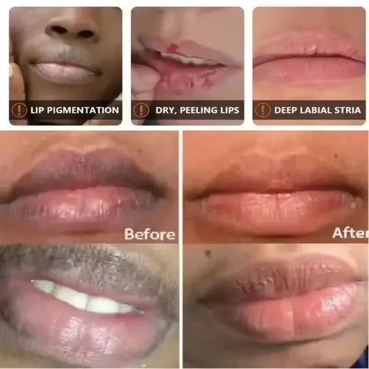 Fast Lighten Melanin Lip Mask Remove Dark Lip Balm Serum Exfoliating Fade Lip Lines Dead Skin Nourishing Repair Lip Care Makeup