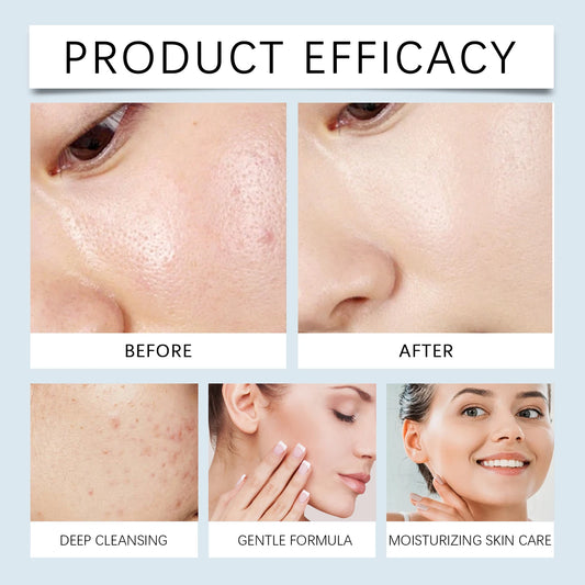 Hoygi 120ml Double Cleansing Gentle Makeup Remover for Face Eyes Soybean Oil Niacinamide No Residue Non Greasy Vegan Cleanser