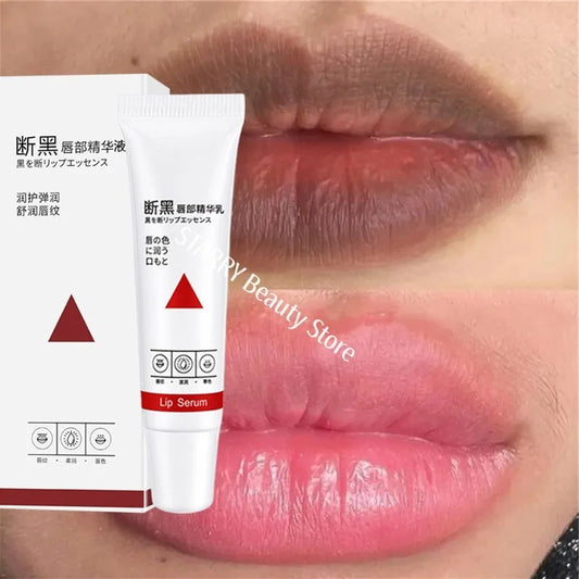 Remove Dark Lip Balm Fast Lightening Pink Lip Exfoliating Fade Lip Line Dead Skin Moisturizer Korean Care Products Beauty Health