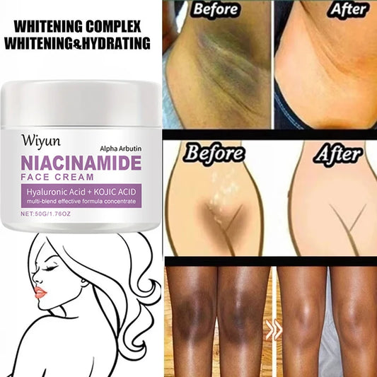 Body Whitening Cream Private Parts Underarm Bleaching Serum Whiten Butt Knee Brighten Inner Thigh Intimate Dark Remove Melanin