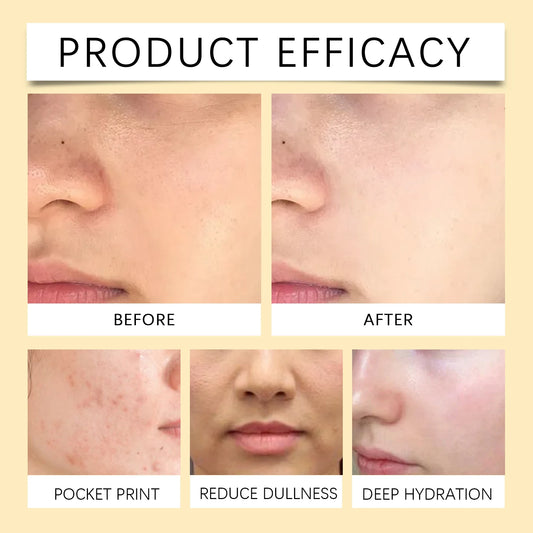 VC Hydrating Toner,Radiance Boosting & Fading Dullness,Triple-Action Oil-Free Plumping,Sun Damage Defense & AntiPhotoaging,Instant Absorption & Zero Sticky Residue,The Ultimate Glow Enhancing Makeup Prep,Vegan & Cruelty Free